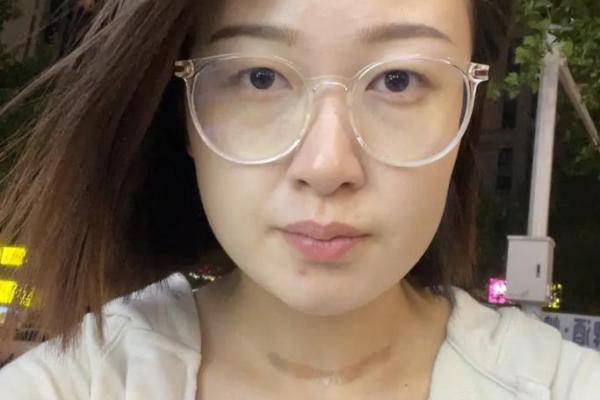 八字纹的女人是穷相吗？