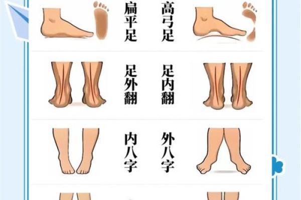 小孩外八字