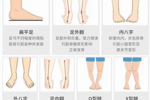 足脊健康知识小课堂（第三期） -  外八字篇