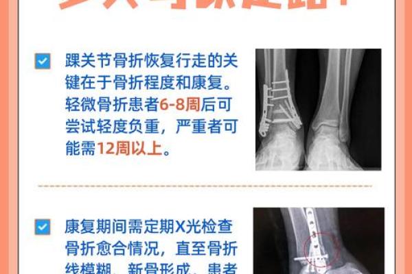 踝关节八字
