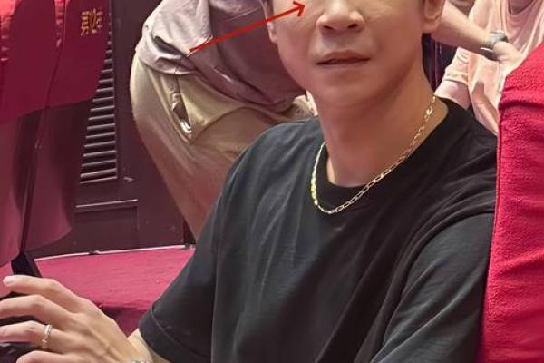 印堂八字纹的男人面相婚姻